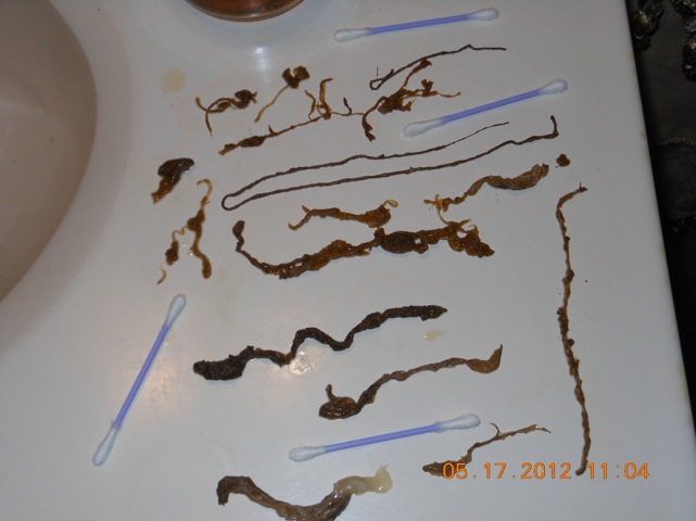 Worms!